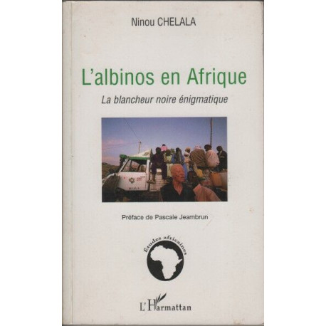 L'albinos en Afrique: La blancheur noire énigmatique